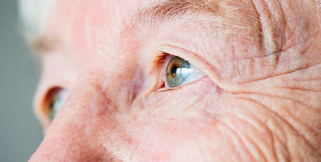 1-preguntas-frecuentes-cirugia-operacion-cataratas-enfermedad-ocular-oftalica